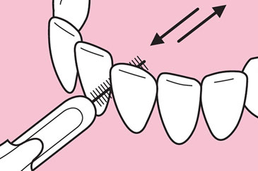 Nutzung Interdentalbürste Nutzung Interdentalbürste