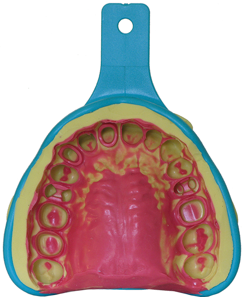 Smoothstar Light Normal pink Abdruck
